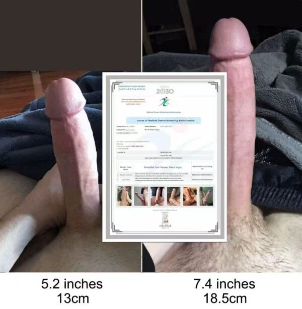 微信图片_20260403103432_28_484 SA68 boosts blood flow to the penis for firm, lasting erections with no side effects.